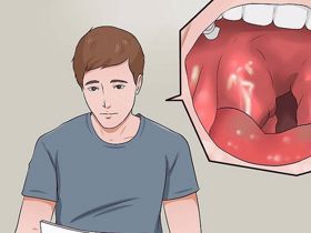 Viêm họng hạt có nguy hiểm không?